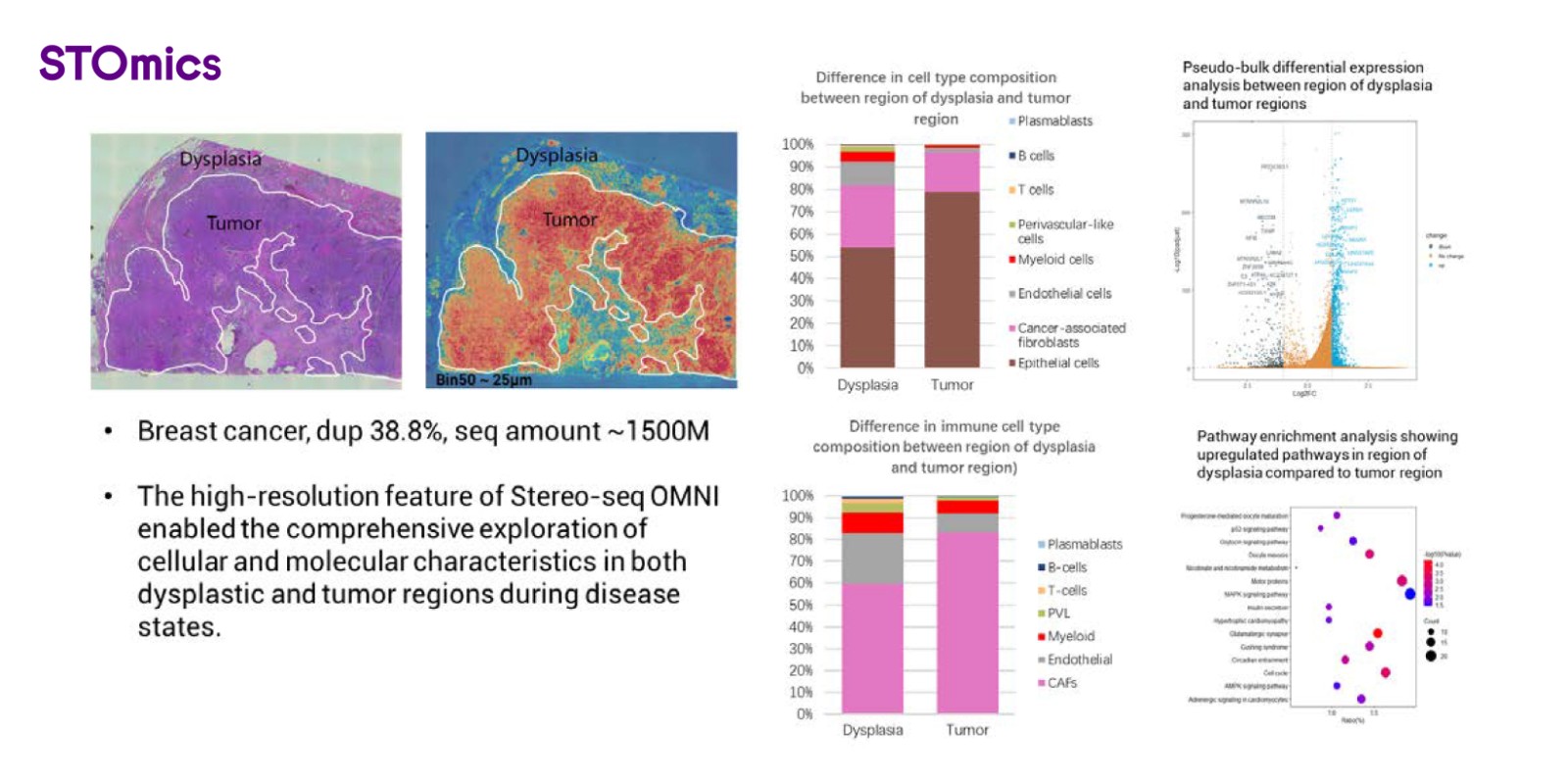 Spatial gene expression profile on breast cancer FFPE sample using Stereo-seq OMNI